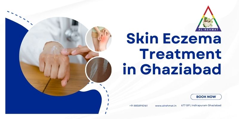 Skin Eczema Treatment In Ghaziabad - Al - Rehmat
